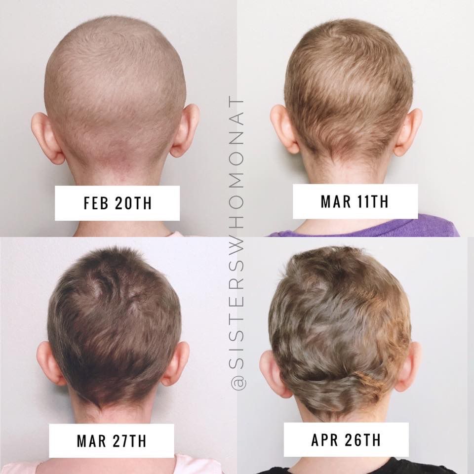 Before and after chemo hair growth