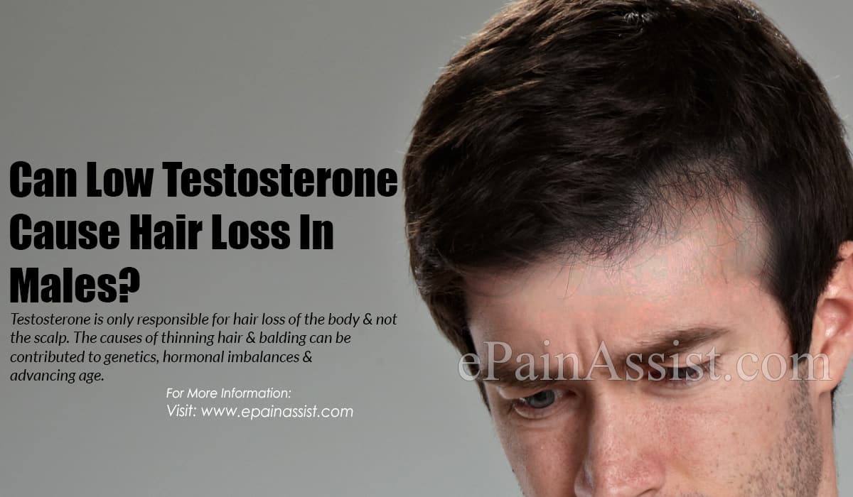 Can Low Testosterone Cause Hair Loss - HairLossProTalk.com