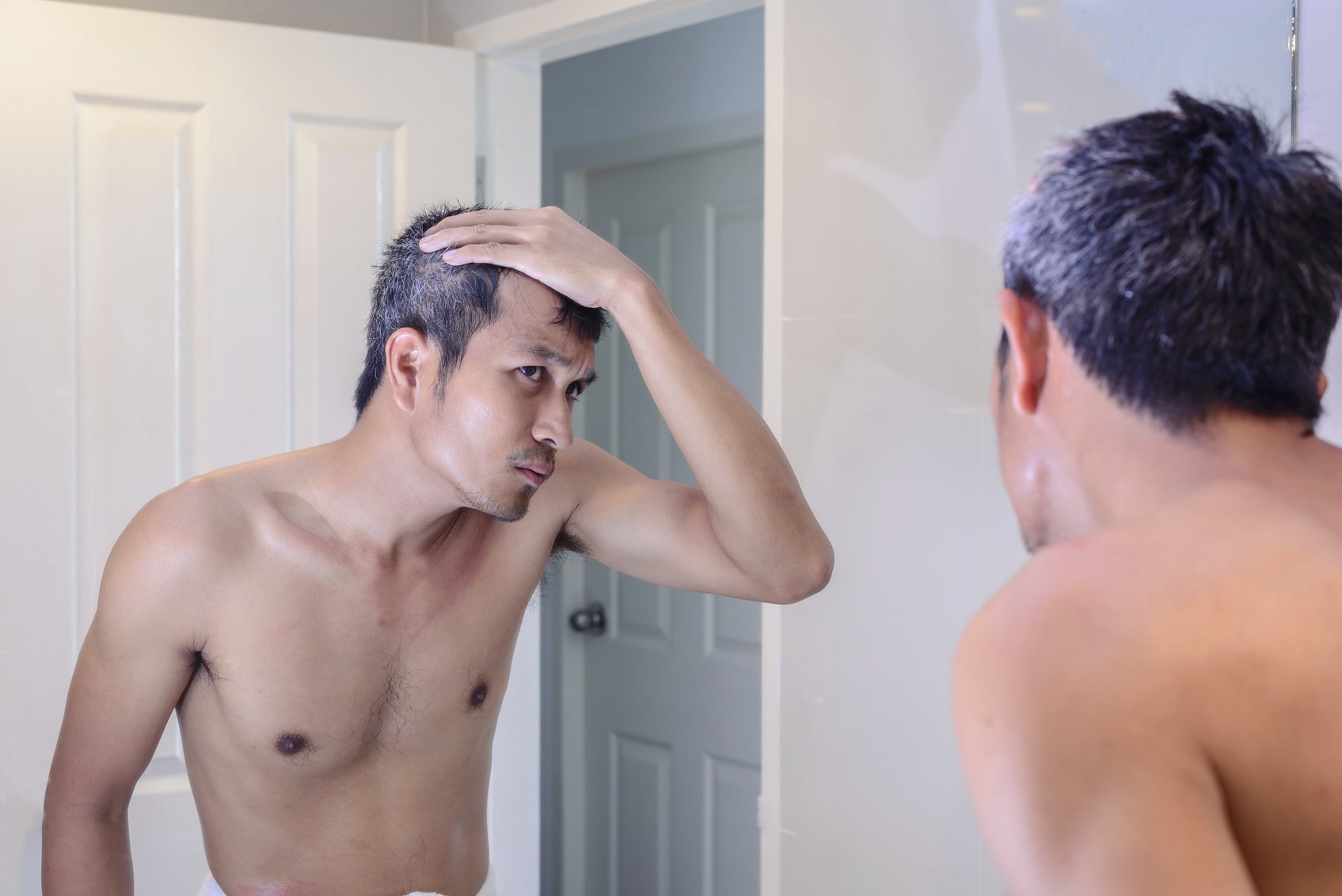 Does Testosterone Cause Hair Loss
