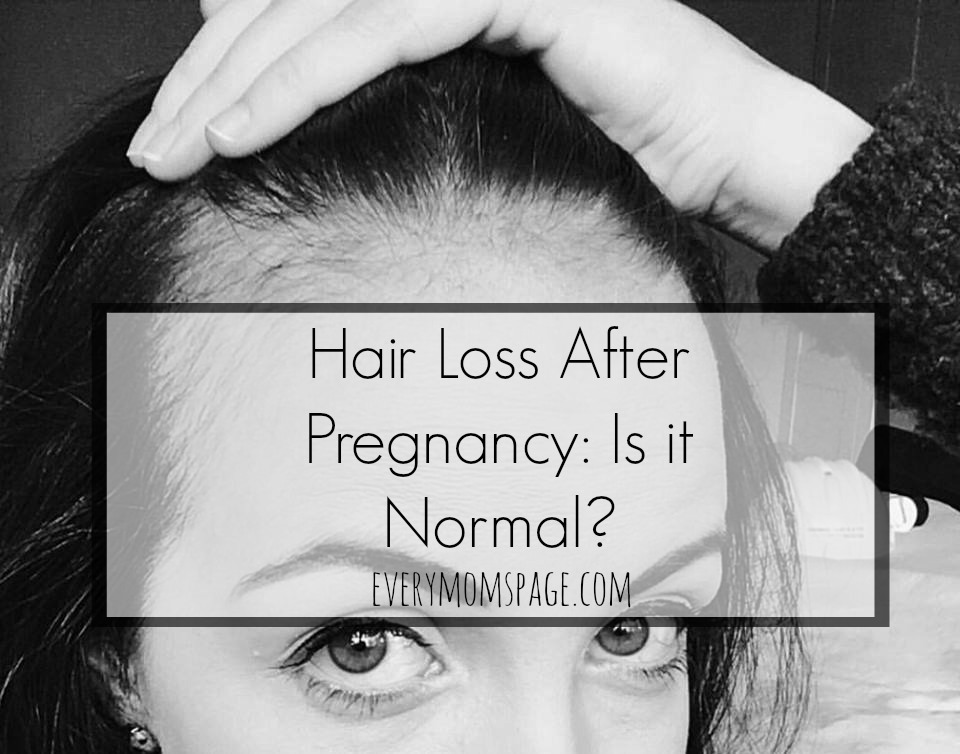 Hair loss after pregnancy.