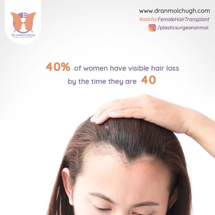 Hair loss in women in 2021