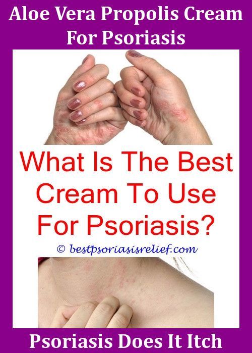 Psoriasisonface Psoriasis Products,ispsoriasisgenetic ...